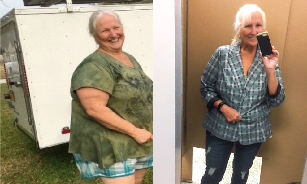 From Plateaus to Progress: My Keto Health Transformation