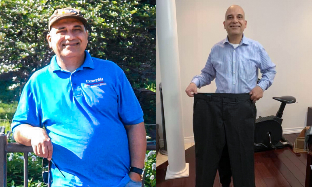 Before and after image of Dr. Duraid AlJailawi