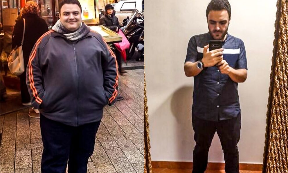 Before and after image of Karim Fares
