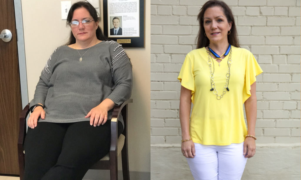 Before and after image Valerie Moore