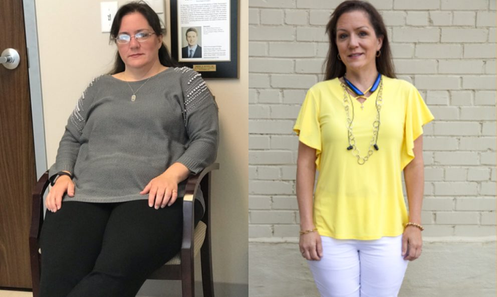 Before and after image Valerie Moore