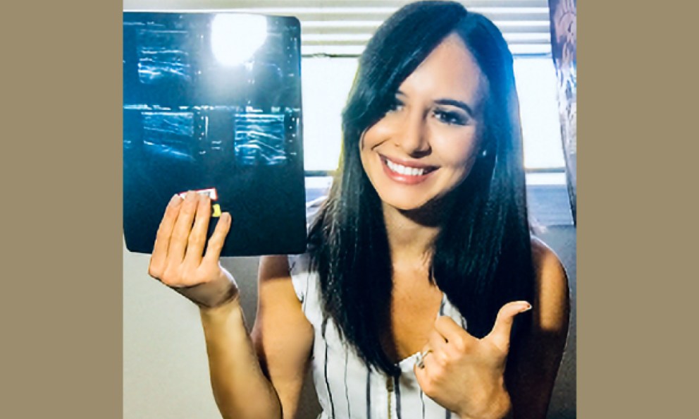 After image of Stephanie