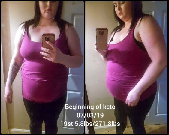 Before images of Anna Hope