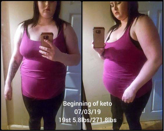 Before images of Anna Hope