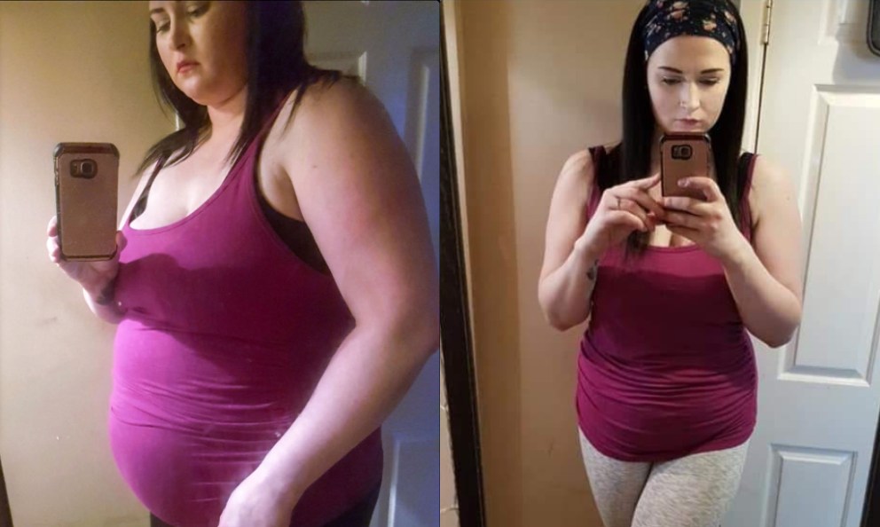 Anna Lost 65 Pounds in Just 12 Weeks&nbsp;Using Keto