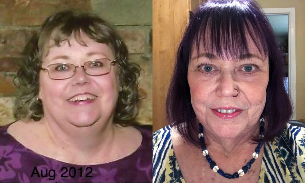 Before and after image of Denise Welch