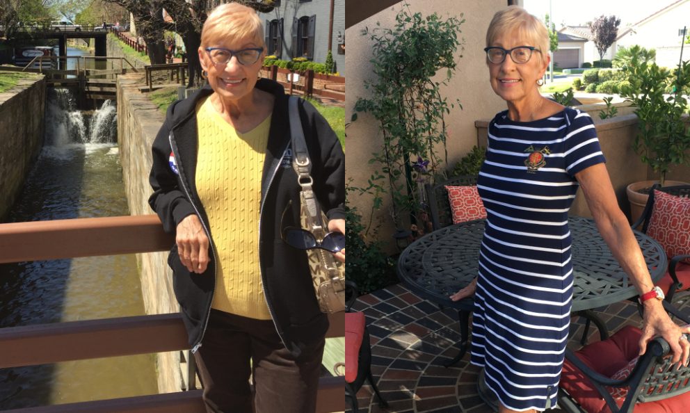 Before and after image of Sharon Geiser