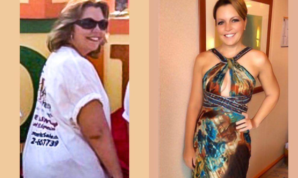 Before and after image of Lori Ballen