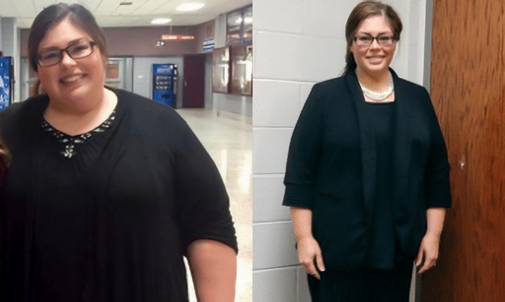 Before and after image of Jenny F.