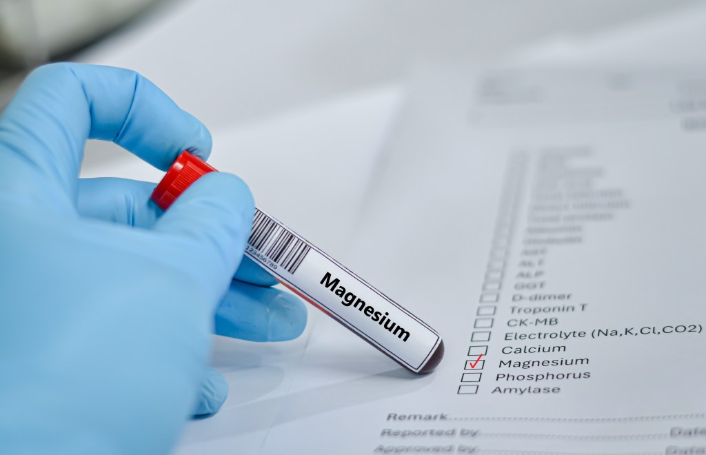 Magnesium blood test