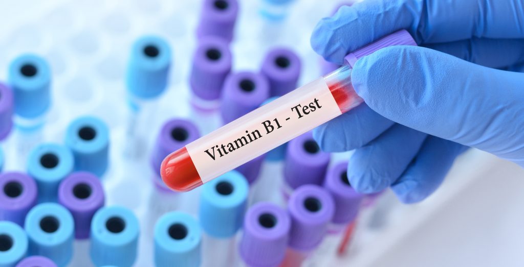 Vitamin B1 test   