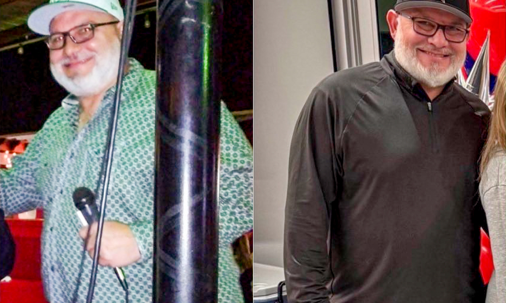 Antonio O. before and after image