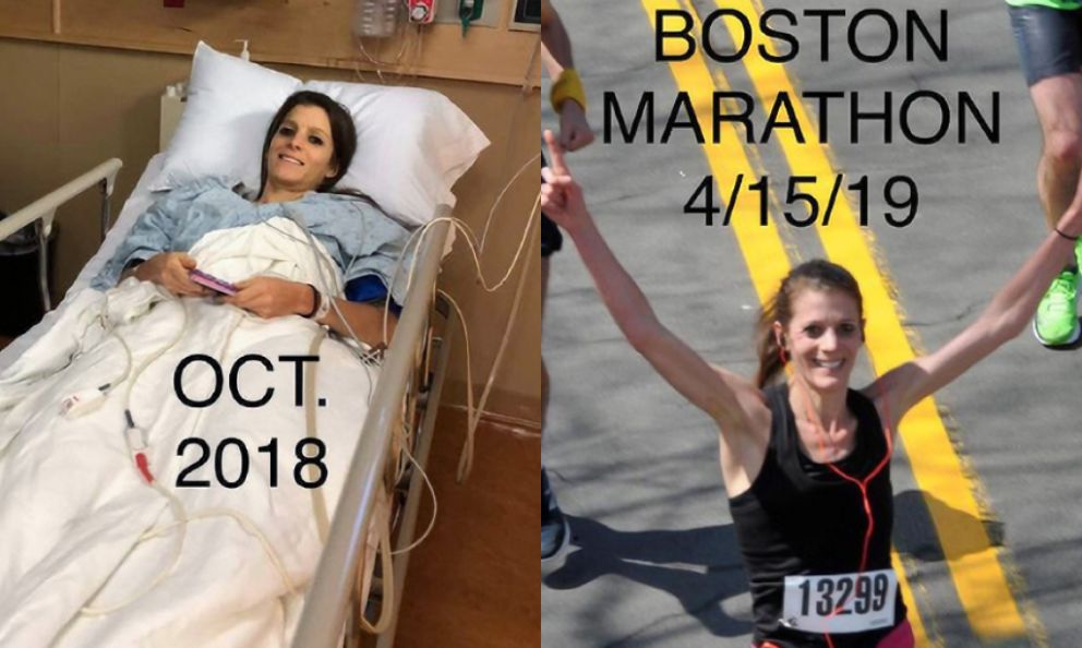 Before and after image of Kristin Barishian