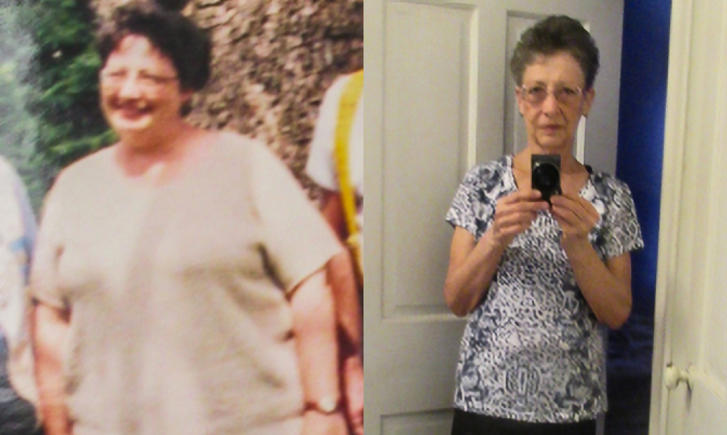 Before and after image of Susan Leishman