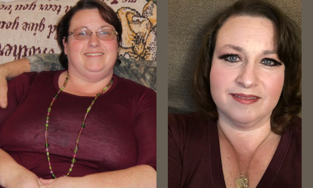 Before and after image of Lucille Roth