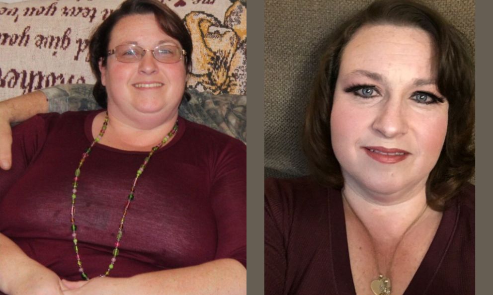 Before and after image of Lucille Roth