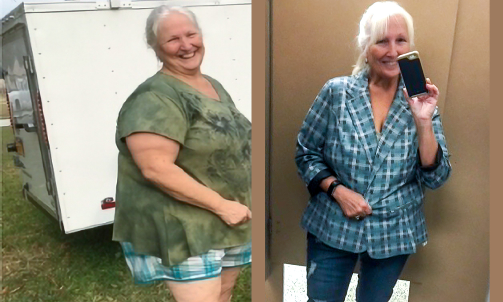 Before and after image of Leanne Tornatore
