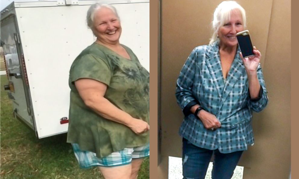 Before and after image of Leanne Tornatore