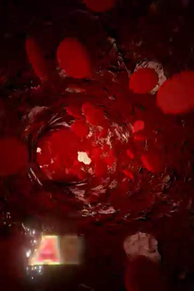 The #1 Best Meal to Clean Out Your Arteries Naturally