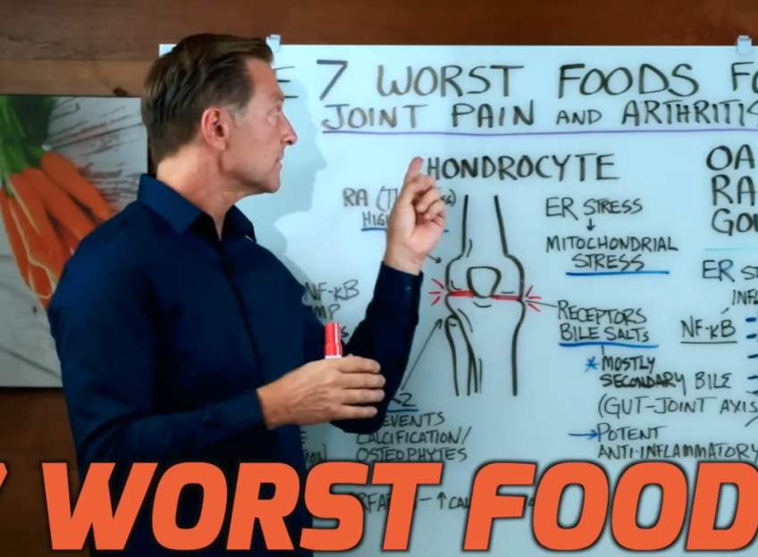 7 Foods to Avoid for Arthritis