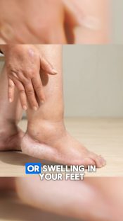 Your Feet Reveal More About Your Health Than You'd Think