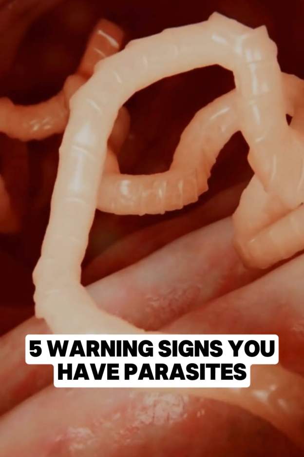 5 Signs You Have Parasites – What You Need to Know