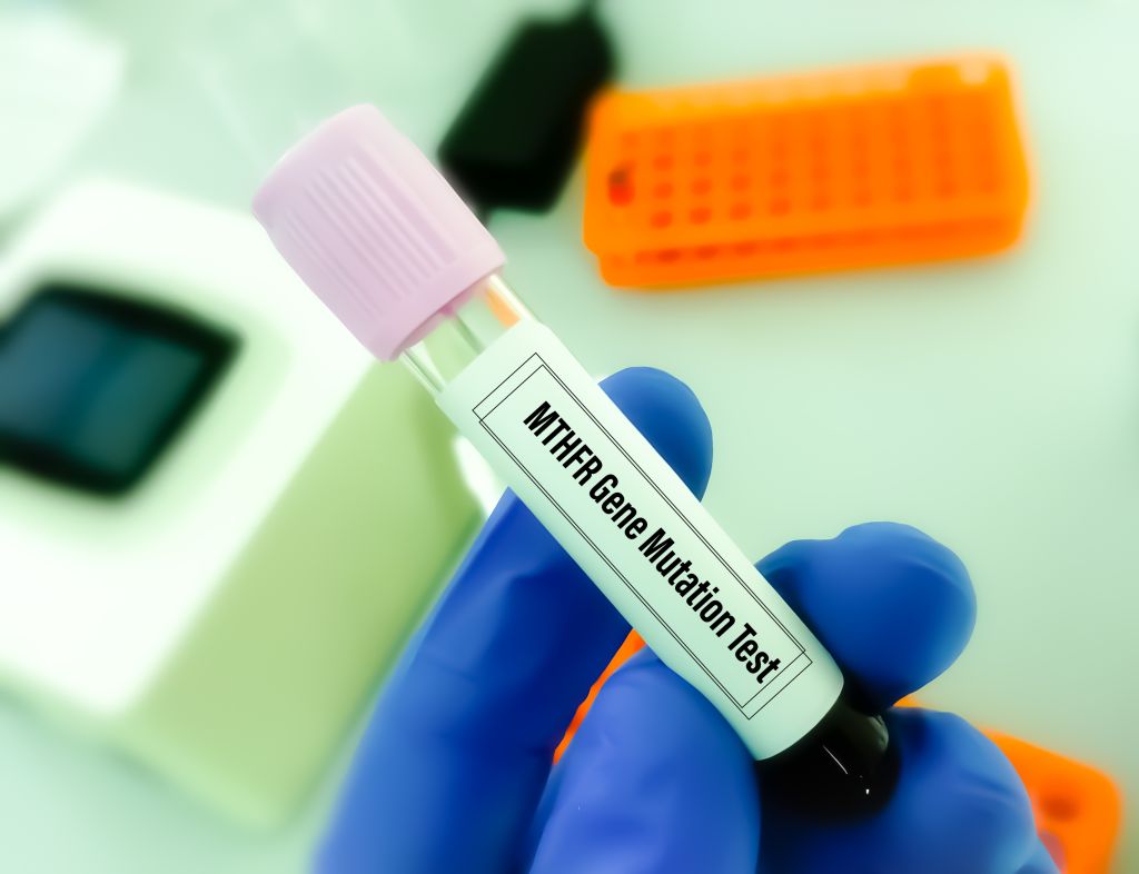 MTHFR genetic mutation test