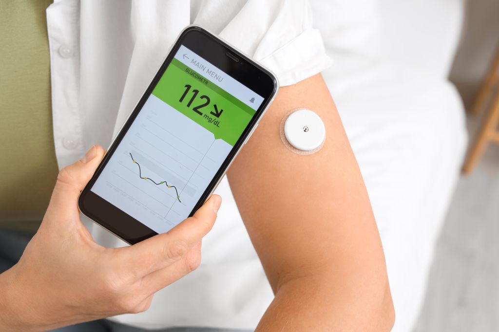 Woman wearing a CGM