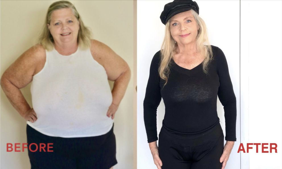 My Keto Journey: How Determination Transformed My Health and Happiness