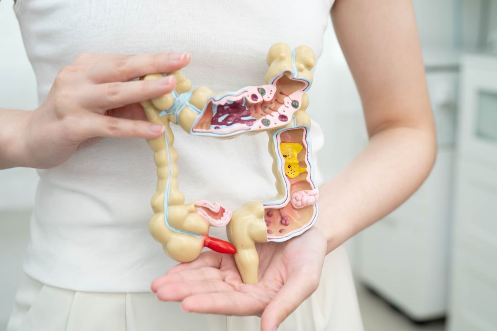 Woman holding a representation of an intestine